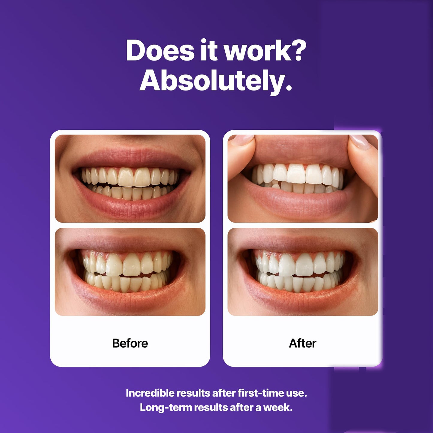 V34 Teeth Whitening Strips – Colour Correcting PAP+ Formula