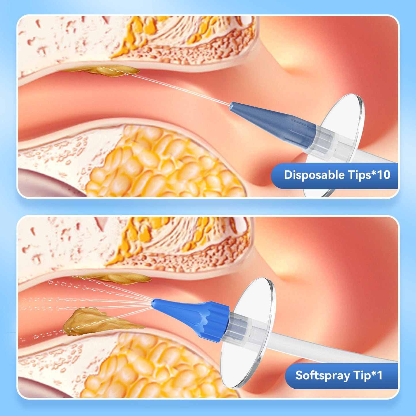 Home Ear Cleaning Tool — Manual Push-Button Design