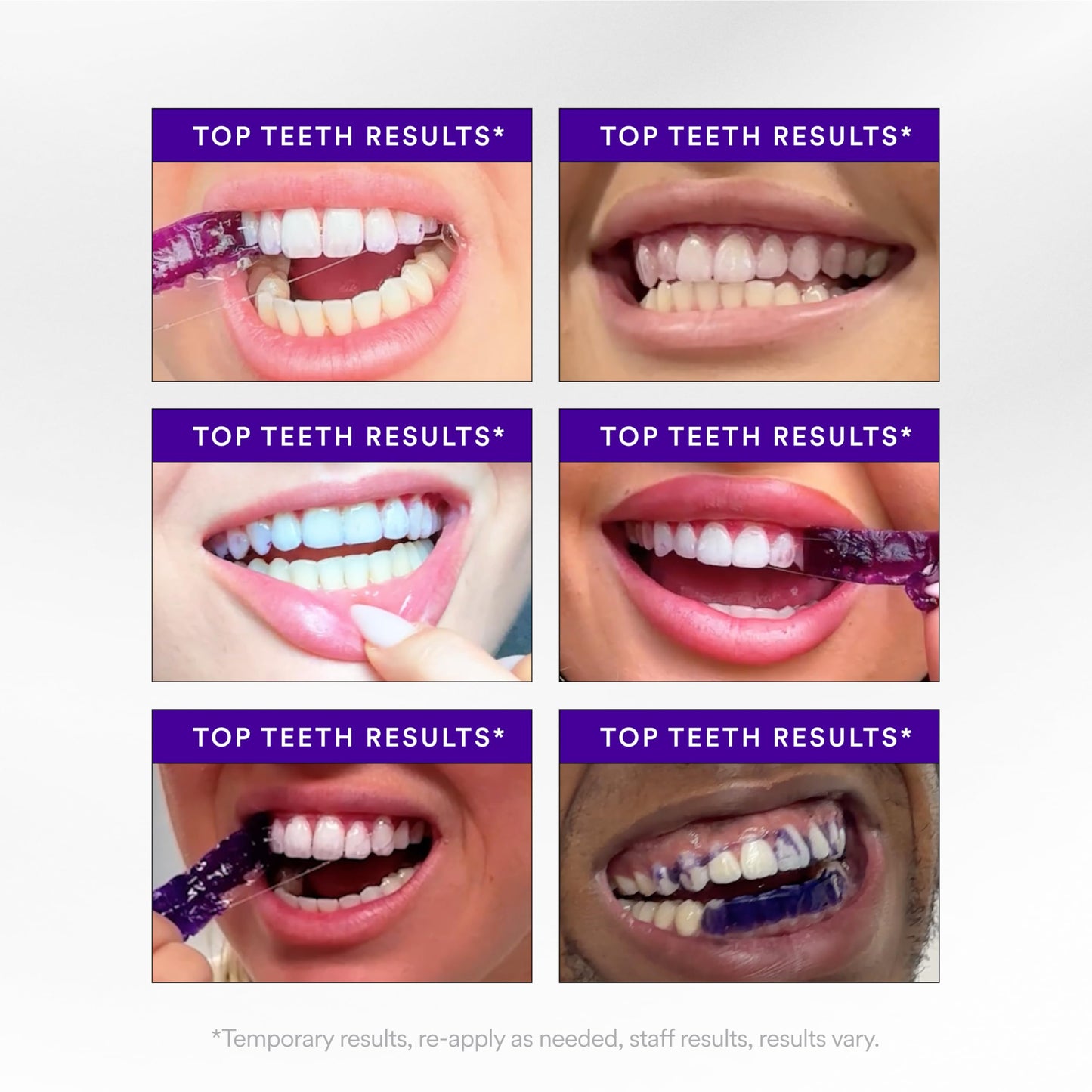 V34Purple Teeth Whitening Strips – Colour Correcting Stain Care