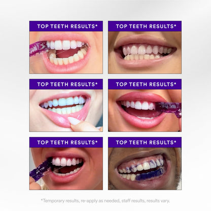 V34Purple Teeth Whitening Strips – Colour Correcting Stain Care